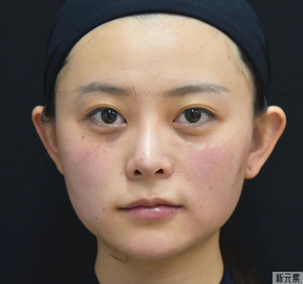 多喝柠檬水不能美白?先了解你的美白上限... 图片-10