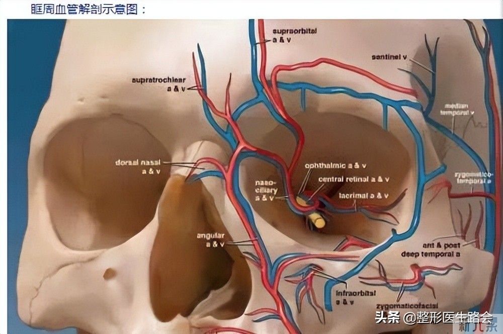 医生没有告诉你的:原来泪沟还可以这样填? 图片-4