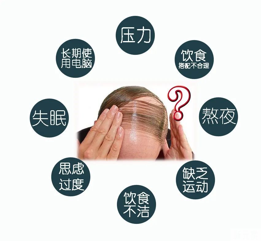 合理预防脱发，保持头发茂密，含泪总结关于你想知道的所有脱发问题 图片-10