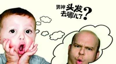 合理预防脱发，保持头发茂密，含泪总结关于你想知道的所有脱发问题 图片-11