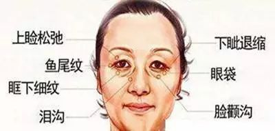 眼袋和泪沟同时存在?不如试试这样做...... 图片-3