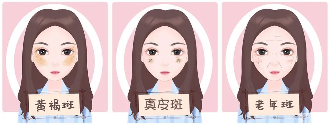 祛斑弯路!为什么有些人的斑反而越祛越多? 图片-3