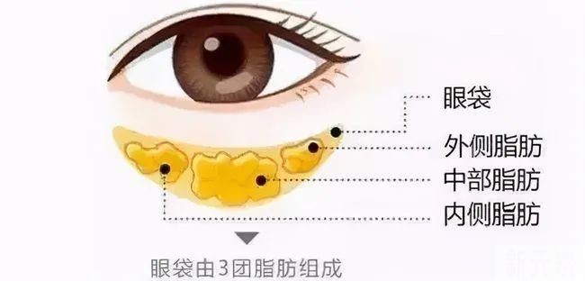 无论你“眼袋”有多深，用这“新”方法，40+岁前都有救! 图片-2