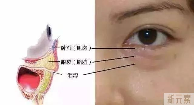 无论你“眼袋”有多深，用这“新”方法，40+岁前都有救! 图片-3