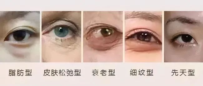 无论你“眼袋”有多深，用这“新”方法，40+岁前都有救! 图片-5