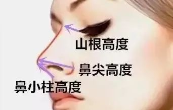 沈阳杏林整形鼻综合案例 图片-11