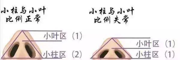沈阳杏林整形鼻综合案例 图片-10