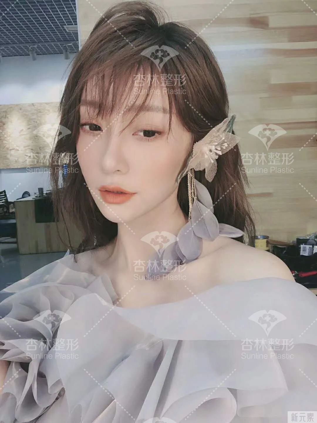 沈阳杏林整形鼻综合案例 图片-16