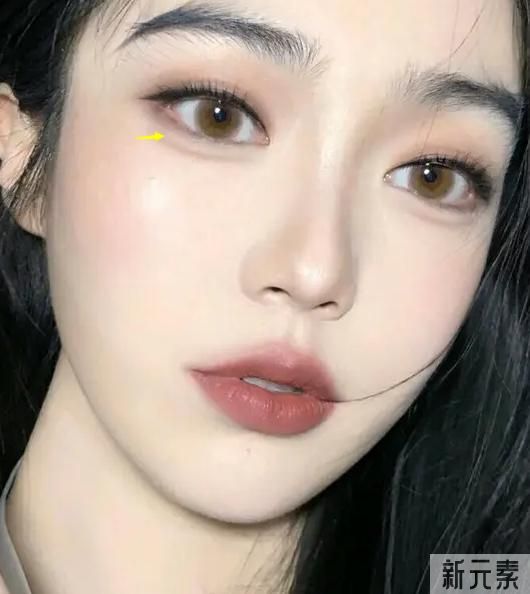 眼袋和卧蚕有什么区别?怎么祛眼袋? 图片-1