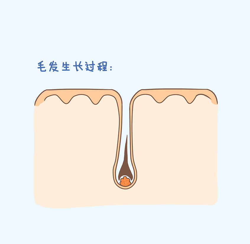 植发前为什么要做皮肤镜检查? 图片-6