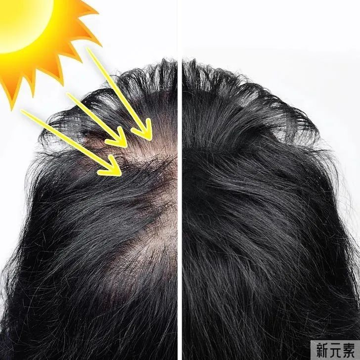 您不怕晒不怕......却让头发更稀疏了 图片-3