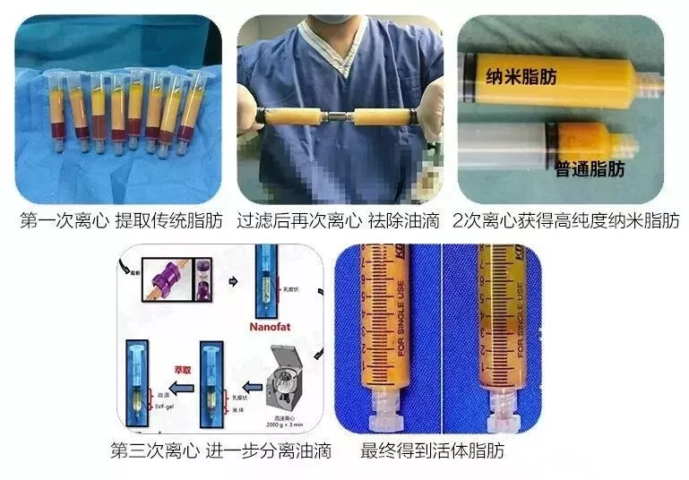 很多人谈之色变的脂肪，其实是个宝 图片-12