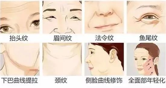 刷爆朋友圈的线雕提升，真的有这么神奇吗? 图片-5
