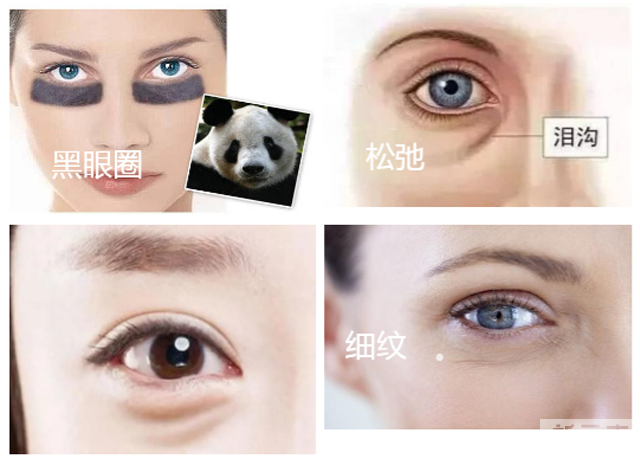 嗨体熊猫针，眼周逆龄抗衰神器 图片-3
