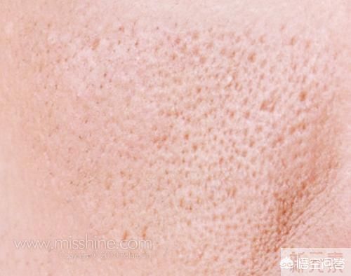皮肤毛孔粗大，有什么好的方法? 图片-1