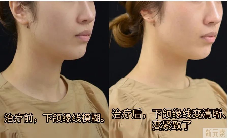 想要保持少女感，光靠脸蛋紧致还不够! 图片-7
