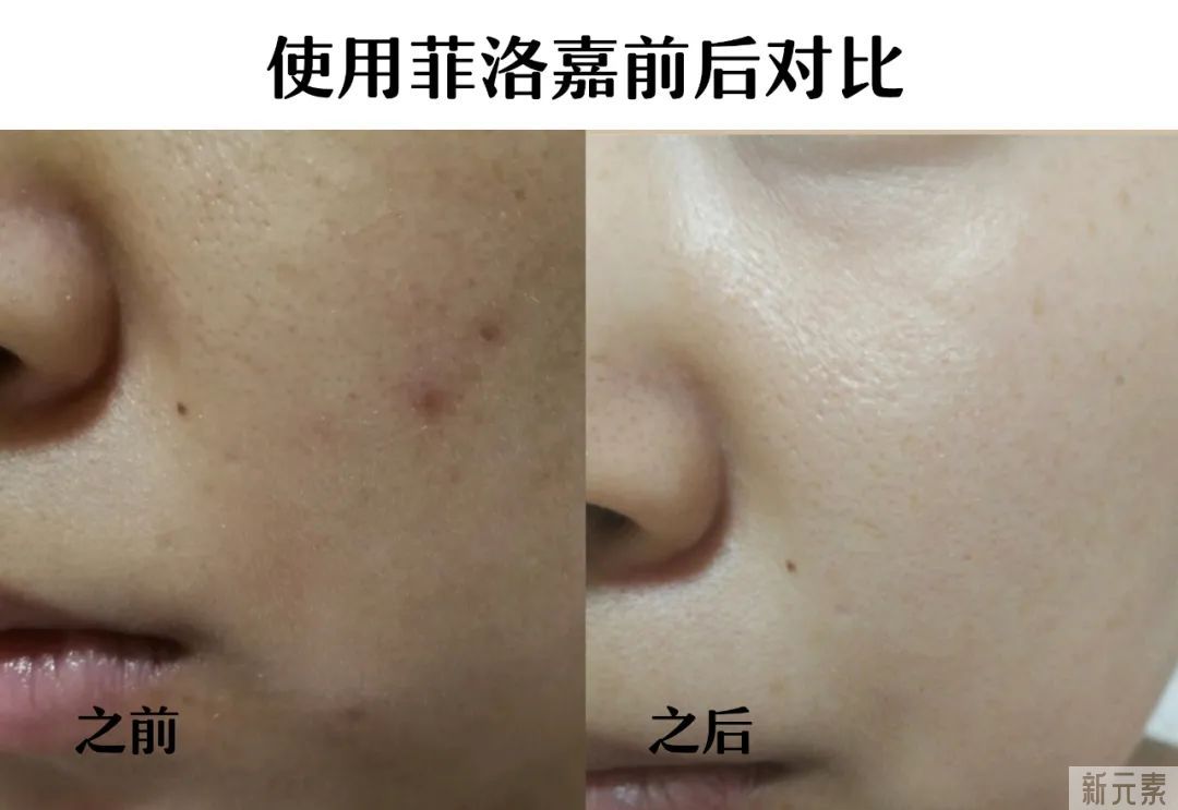 想要保持少女感，光靠脸蛋紧致还不够! 图片-18