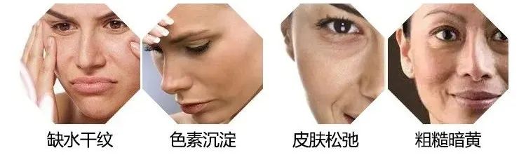 宅家没晒太阳，脸咋还变黑了? 图片-2