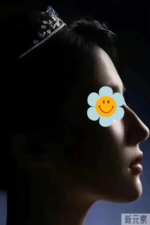 神仙姐姐都说好的美鼻类型来了! 图片-9
