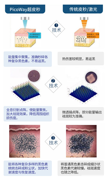 超皮秒:强于祛斑 又不止于祛斑 图片-4