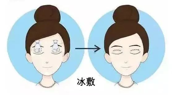 都是同一天做的双眼皮，为啥她恢复这么快? 图片-12