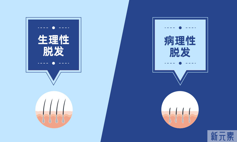 如何判断脱发原因和类型?如何正确治疗? 图片-2