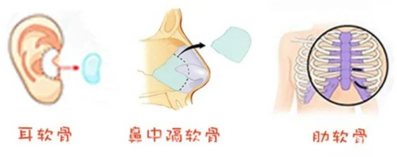 面部凹陷、土气显老，这些颜值Bug竟是因为它! 图片-6