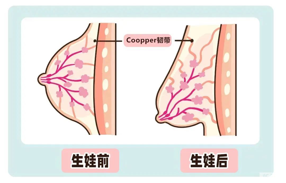 乳房为何会下垂?母乳喂养会导致乳房下垂吗? 图片-10