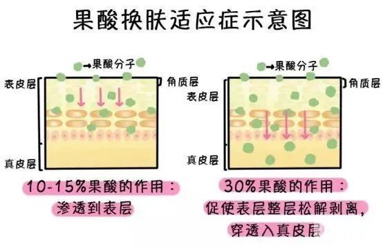 刷酸到底会不会让皮肤变薄?真的酸q了... 图片-8