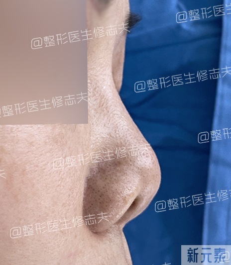 问题鼻型盘点，看看有没有你的同款? 图片-10