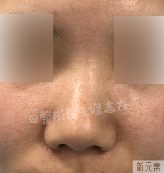 问题鼻型盘点，看看有没有你的同款? 图片-21