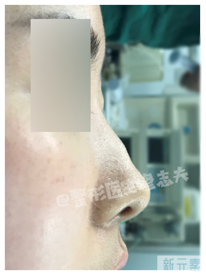 问题鼻型盘点，看看有没有你的同款? 图片-25