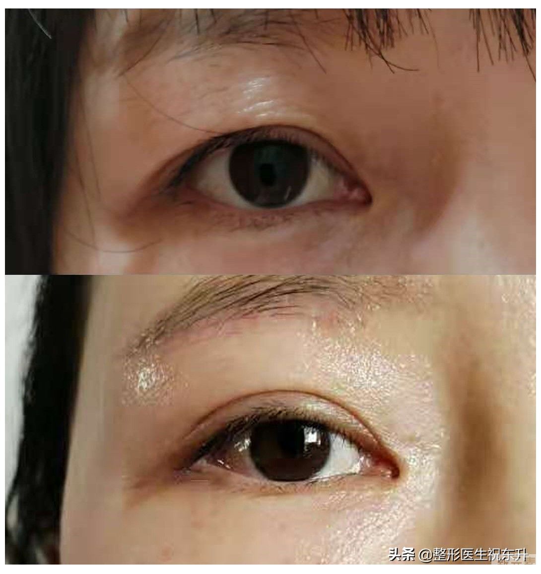 千万别“提眉”，会留疤，一辈子去不掉?   图片-1