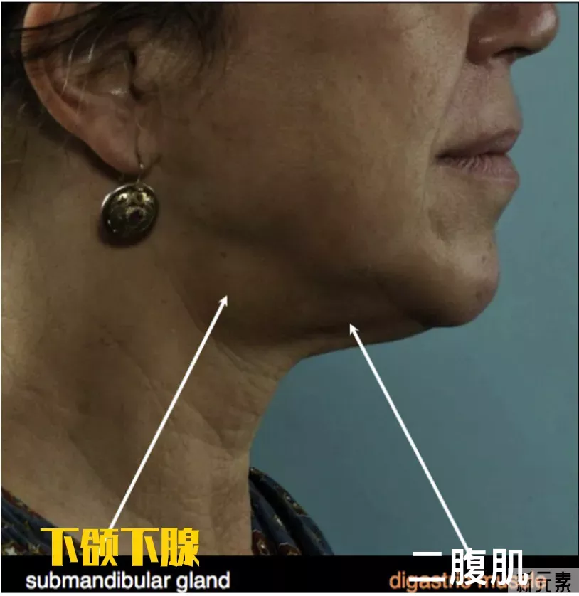 脖子松弛、下垂怎么办?讲讲大家都忽略的颈部年轻化  图片-6