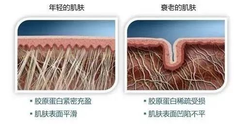 超硬核除皱攻略，脸上没皱纹的感觉太好了! 图片-3
