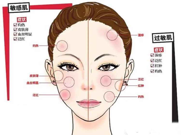 敏感肌换季自救指南!对“痛苦面具”say拜拜 图片-3