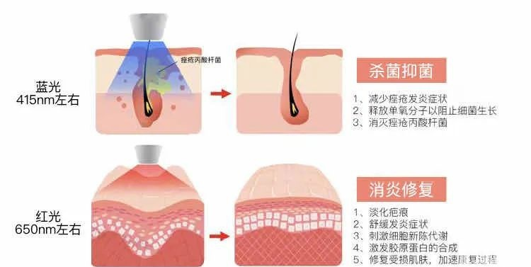 敏感肌换季自救指南!对“痛苦面具”say拜拜 图片-4