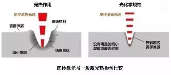 为什么皮秒这么火?真能美白祛斑一步到位? 图片-6