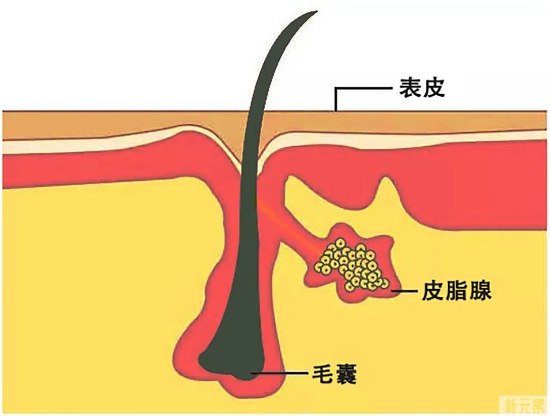 抿嘴时下巴凸起的白色小颗粒是什么? 图片-4