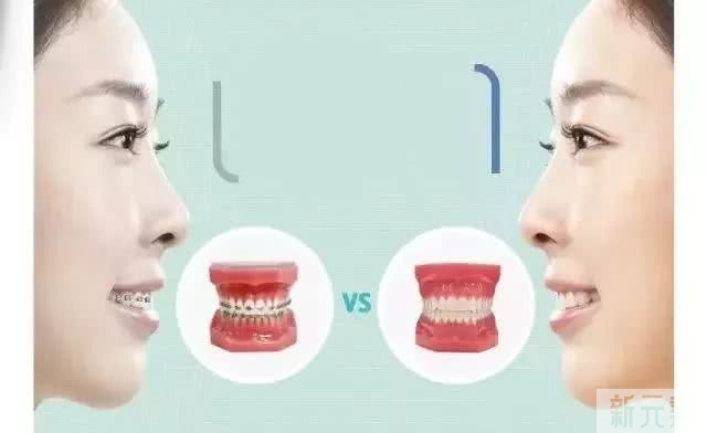 牙齿“矫正”的那些不为人知的事儿...... 图片-9