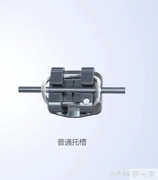 牙齿“矫正”的那些不为人知的事儿...... 图片-11