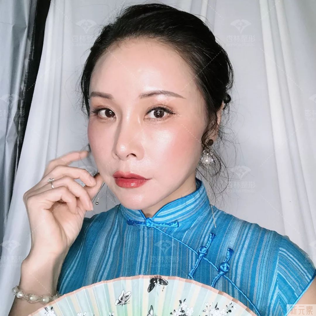 改善眼皮下垂，切开双眼皮和悬眉怎么选? 图片-13