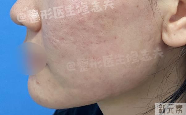 用牙膏洗脸可以吗? 图片-3
