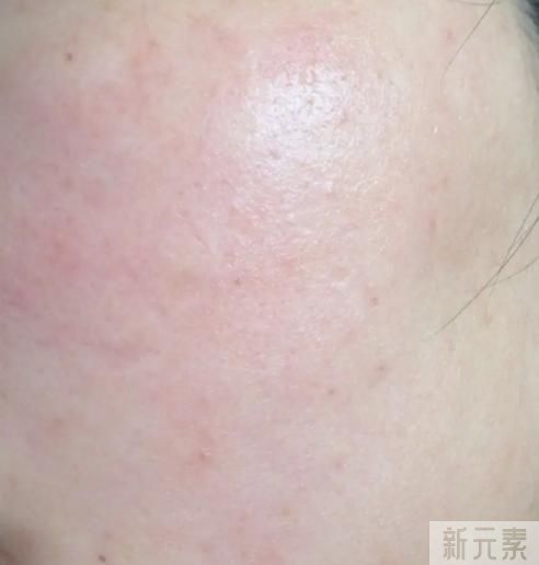用牙膏洗脸可以吗? 图片-2