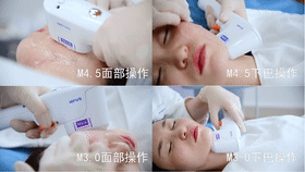 当今医美顶流仪器怎么选?看完这篇省几万! 图片-5