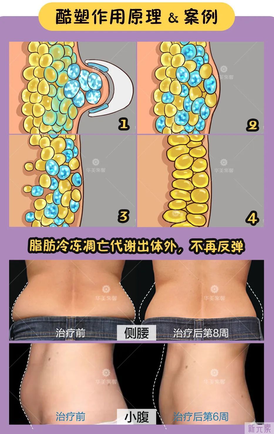 当今医美顶流仪器怎么选?看完这篇省几万! 图片-9
