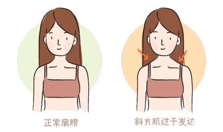 【瘦瘦精选】一到夏就抢爆的注射三瘦，我先美为敬! 图片-8