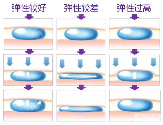 总被小细纹、干瘪脸困扰?你需要一只雅致! 图片-5