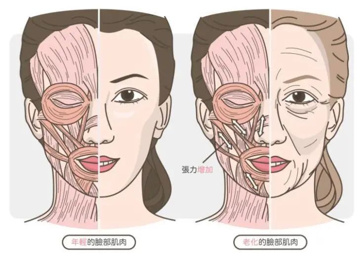 衰老的九大特征，看看你有没有?(内附解决办法!) 图片-14