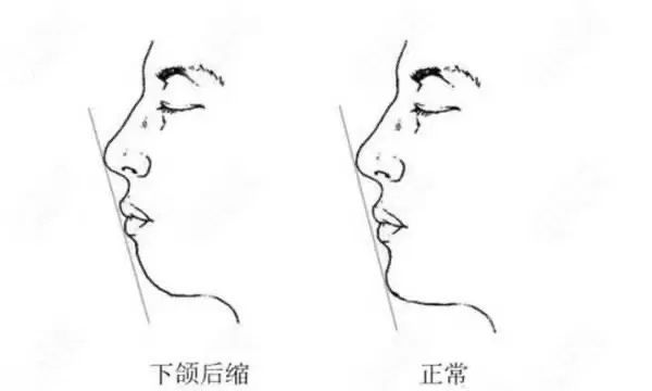 皮相or骨相|如何判断自己的脸是否耐老? 图片-11